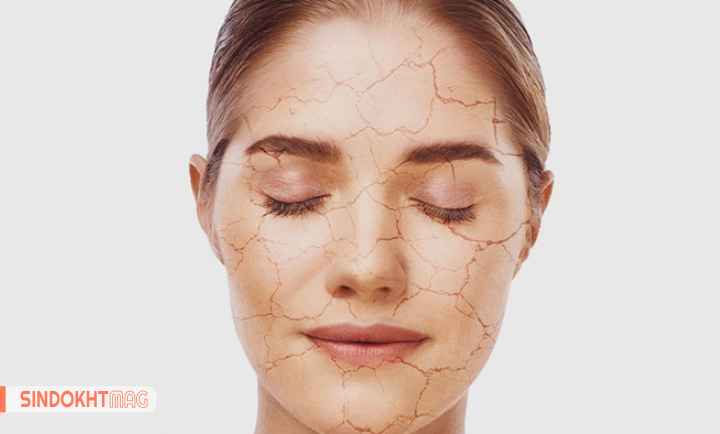 تاثیر کار و سبک زندگی بر سلامت پوست خشک