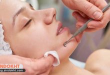 از بین بردن جوش سرسیاه، چگونگی از بین بردن آن
