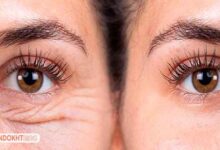 کرم ضد چروک قوی صورت را بشناسید!