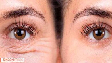 کرم ضد چروک قوی صورت را بشناسید!